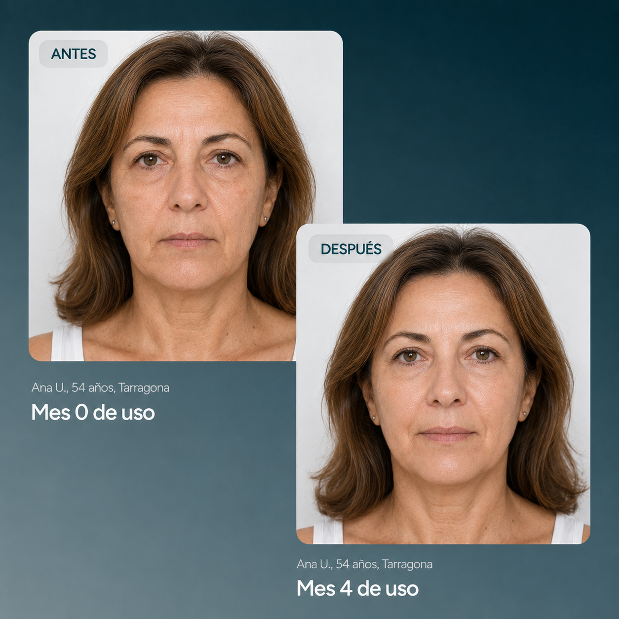 EMULSIÓN HIDRATANTE ILUMINADORA CON VITAMINA C 50 ML