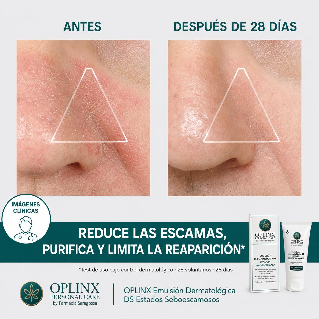 DERMATOLOGICAL EMULSION DS 50 ml